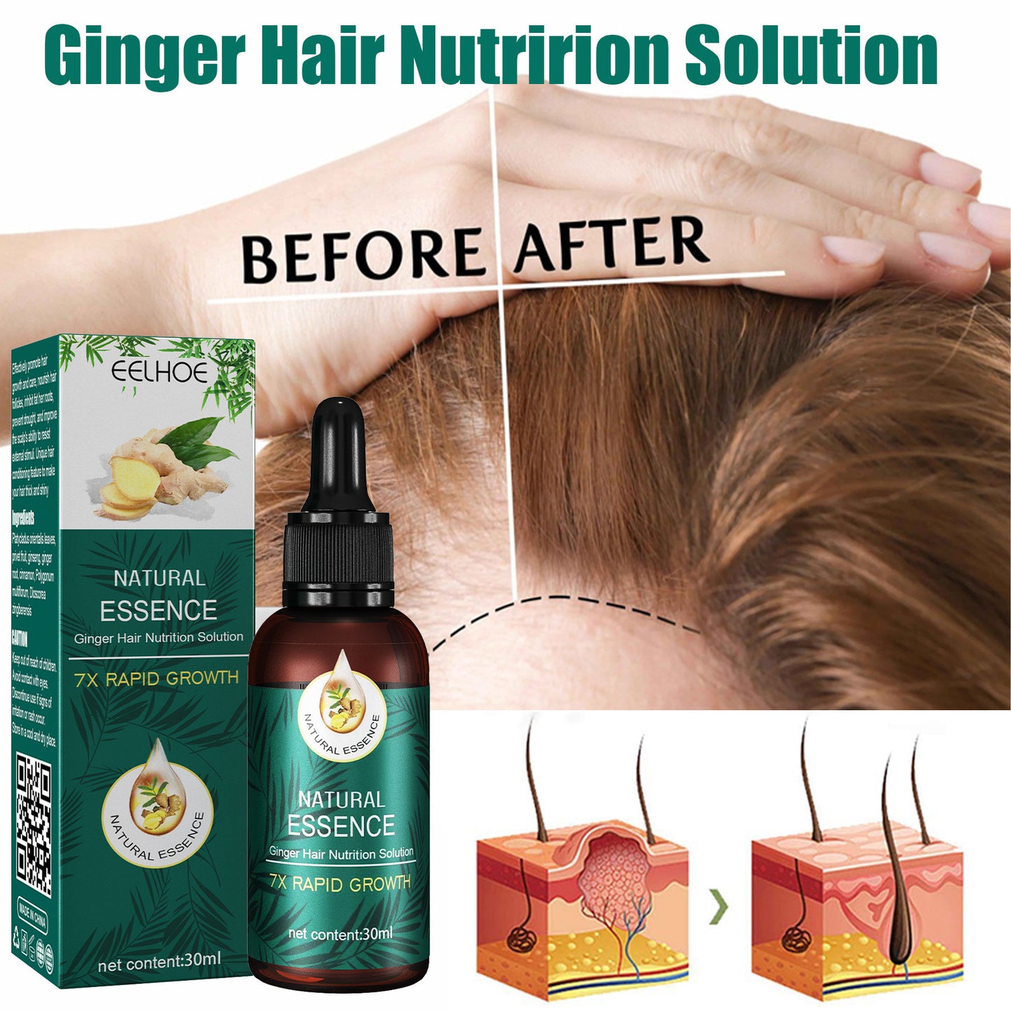 EELHOE Mature Ginger Up Hair Care Essential Oil